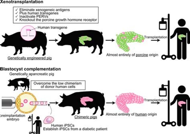 What is meant by xenotransplantation?