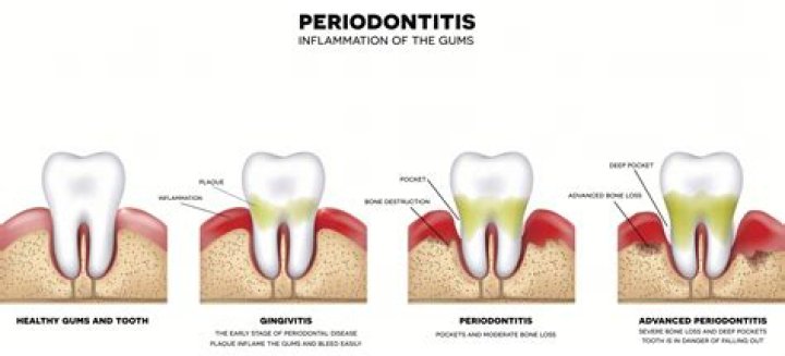 What kind of surgeries do periodontists do?