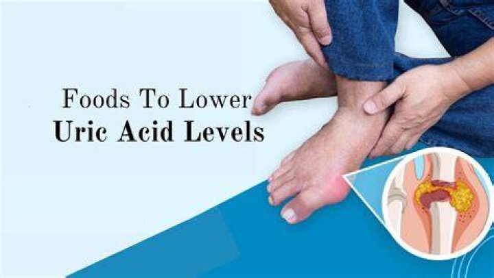What level of uric acid is gout?
