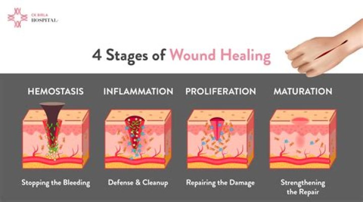 What medications can delay wound healing?