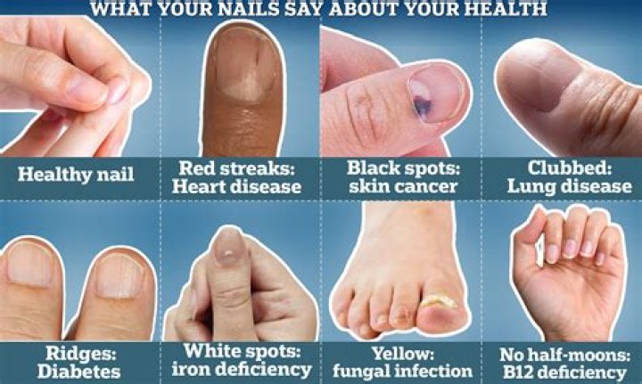 What poison turns your fingernails black?