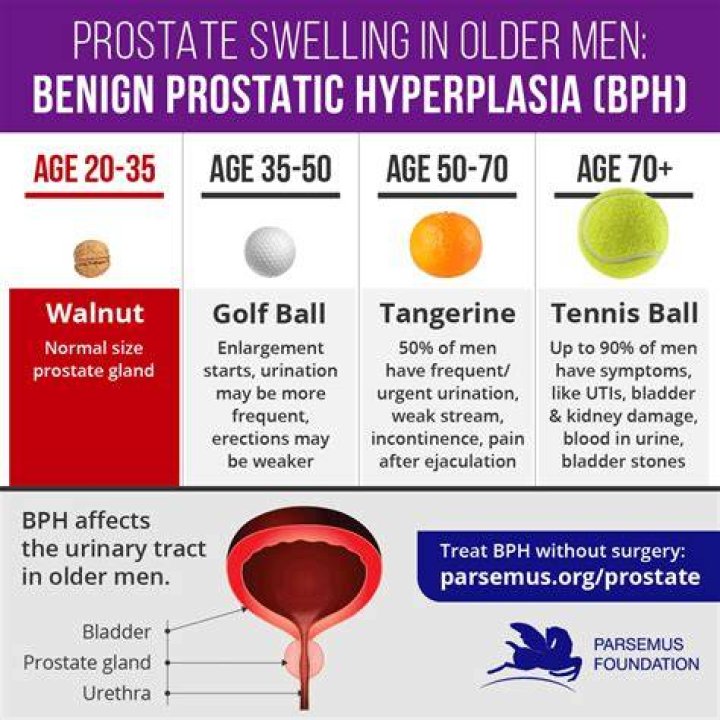 What size is considered a large prostate lesion?