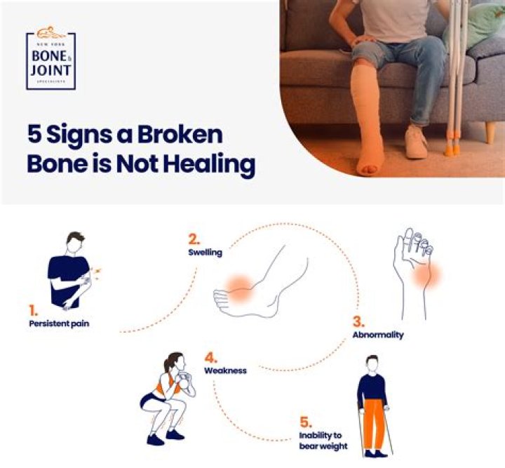 When does a broken bone stop hurting?