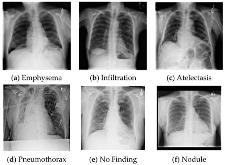 Which doctors can treat pneumonia?