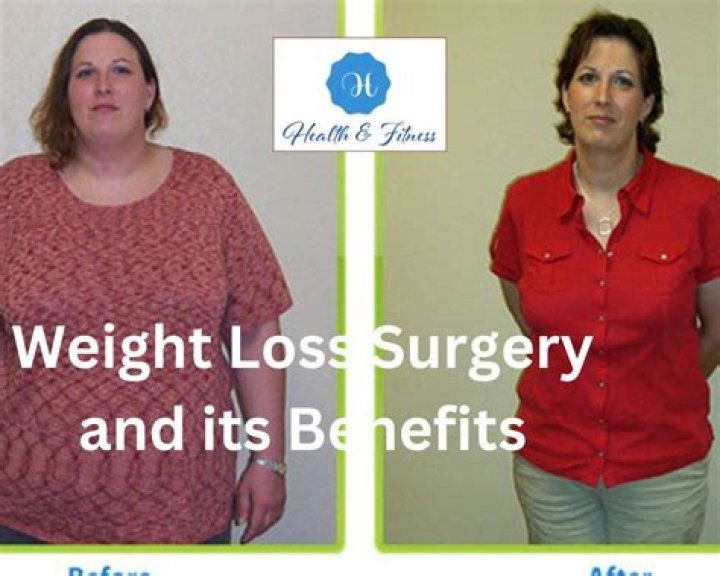 Who should not get weight loss surgery?