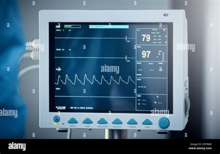 Why do we need to monitor your heartbeat?