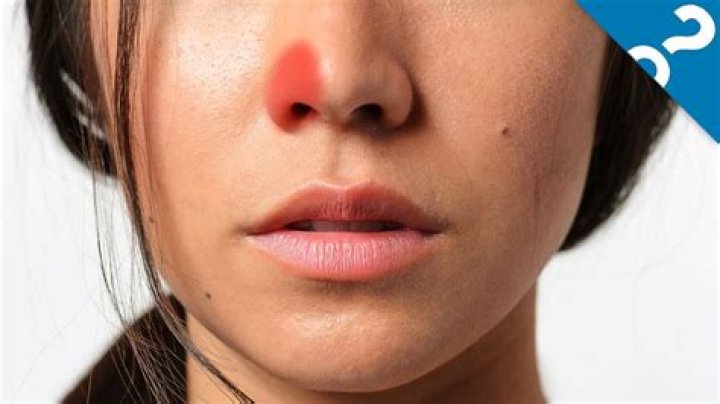 Why does one nostril get clogged and then switch?