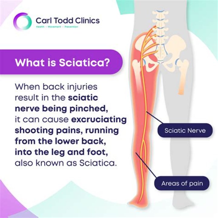 Why does sciatica occur?