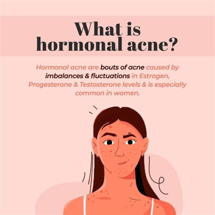 Why is hormonal acne on chin?