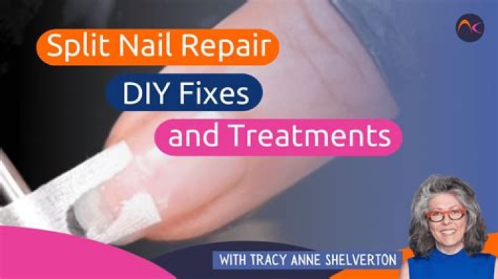 Will a split nail repair itself?